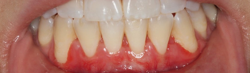 Periodontist in Baltimore