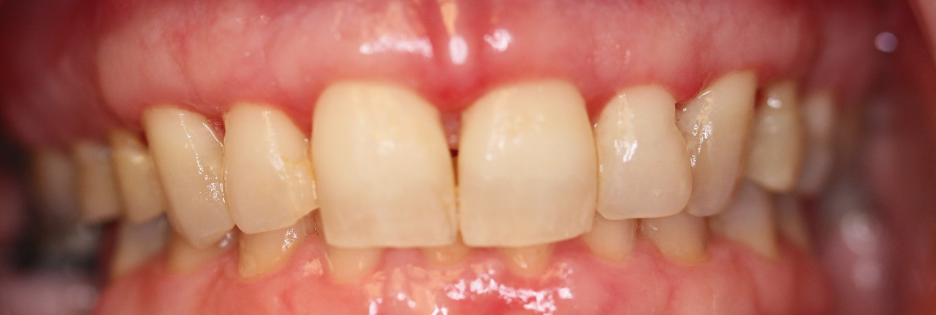 Periodontist in Baltimore