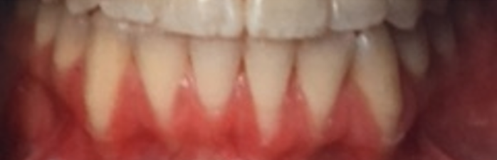 Periodontal Office in Pikesville