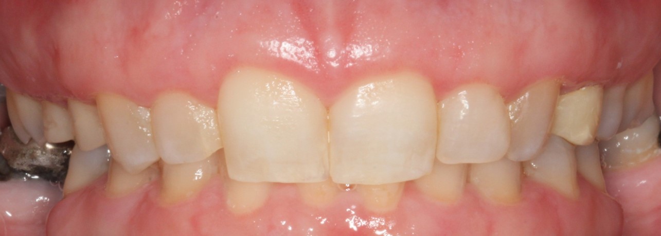 Periodontal Office in Pikesville