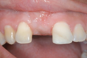 Periodontal Office in Baltimore