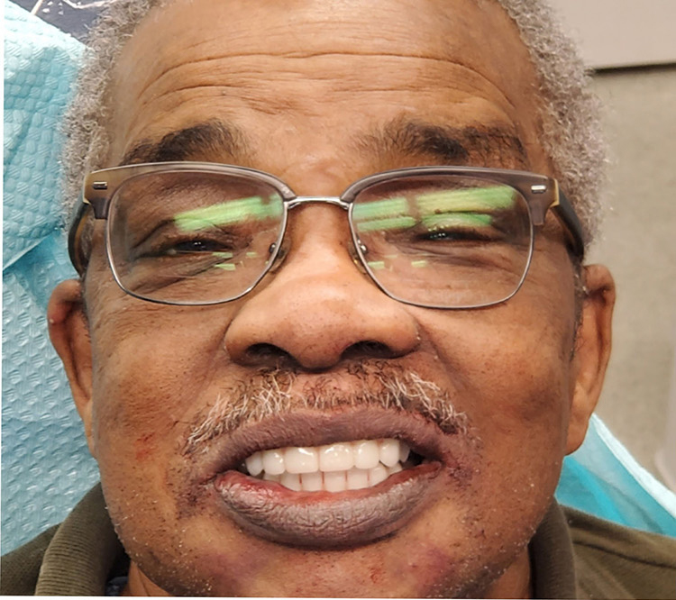 Same Day Smile in Baltimore