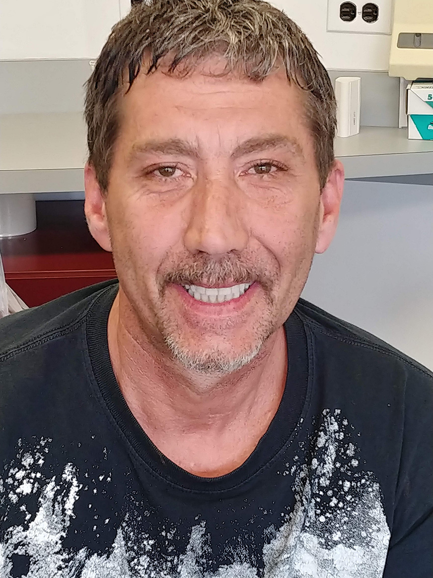 Dental Implants Baltimore