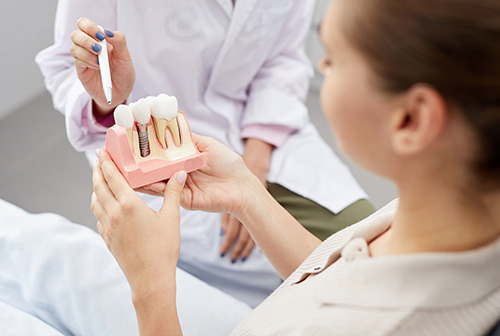 Maryland Center for Periodontics and Dental Implants | Scaling and Root Planing, Pocket Elimination Osseous Surgery and Soft Tissue Grafts