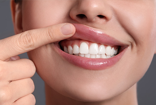 Maryland Center for Periodontics and Dental Implants | Initial Periodontal Exam, Pocket Elimination Osseous Surgery and Bone Grafting